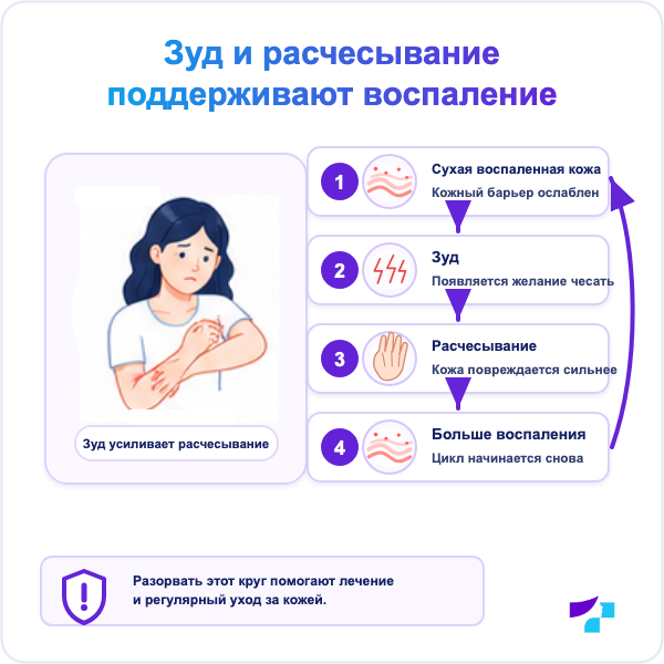 Круг зуда и расчесывания при атопическом дерматите